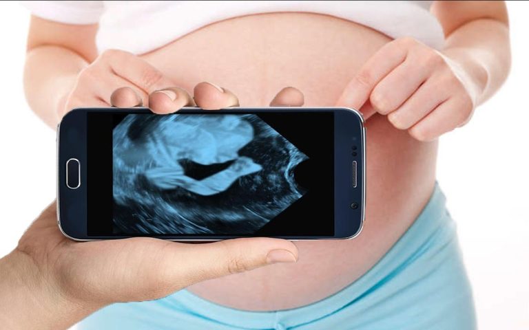 Aplicativo de Ultrassom: Veja Seu Bebê no Celular